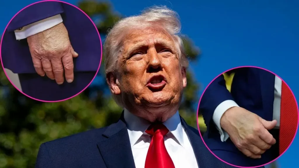 trump health